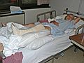 August 21, 2007 - Palm Drive Hospital, Sebastopol, California.<br />Joyce with her operated leg (steel rod and screws).