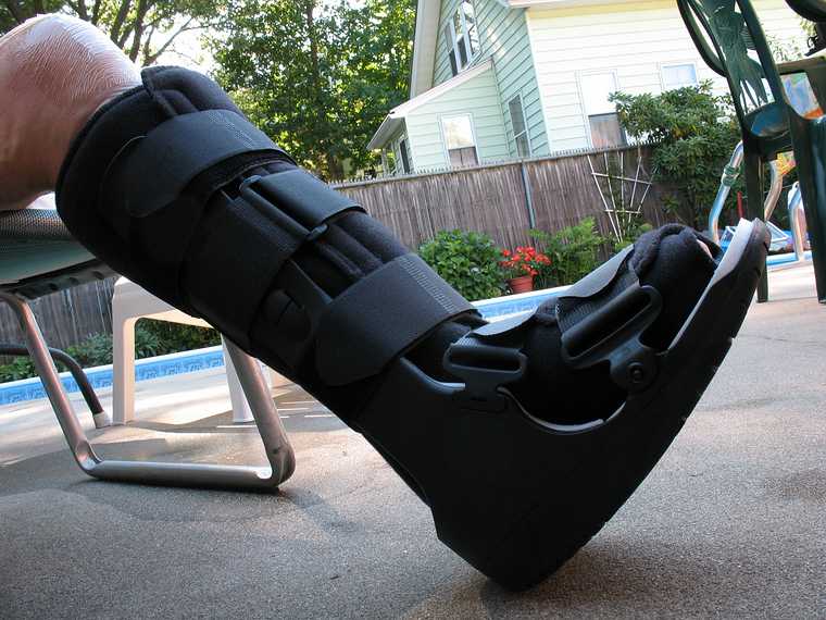 Sept. 2, 2007 - Lawrence, Massachusetts.<br />Joyce's broken leg in the boot.