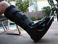 Sept. 2, 2007 - Lawrence, Massachusetts.<br />Joyce's broken leg in the boot.
